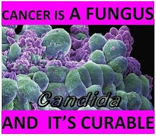 http://4.bp.blogspot.com/_jXK087ZJfNY/S8uA5LFuSFI/AAAAAAAAFn8/lYCkl_MzET0/s320/CancerFungusCandidaMed.jpg