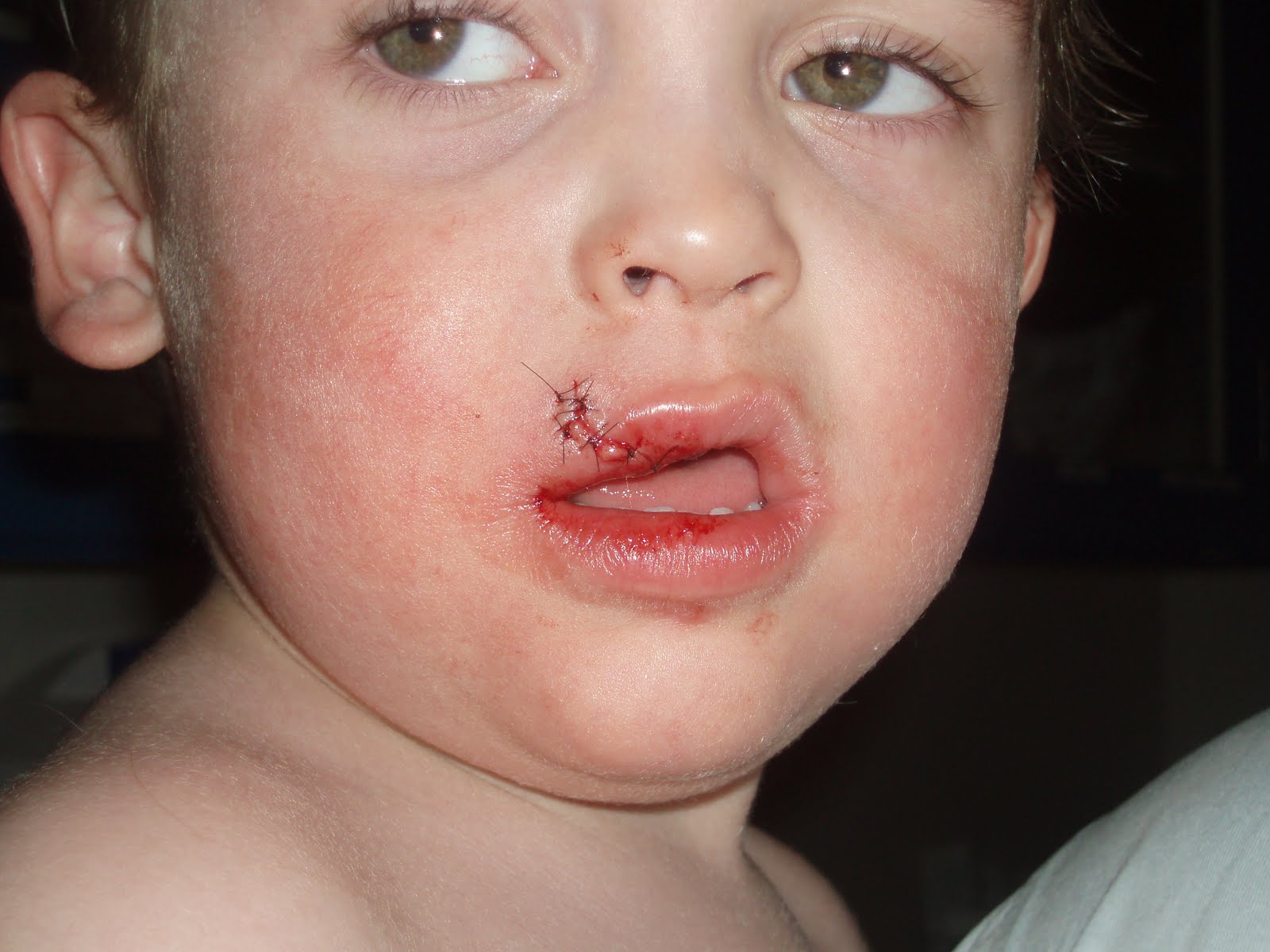 A Beagle and A Baby Healing