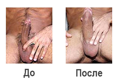 Как реально увеличить член способы увеличения пениса