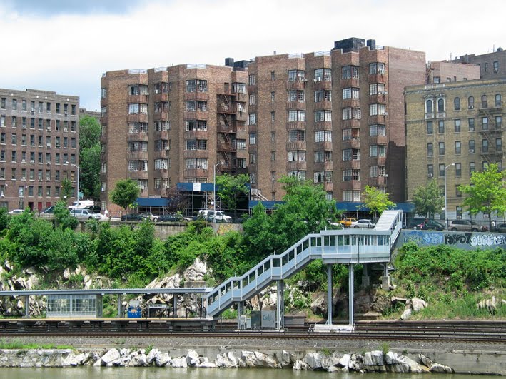 Will I Die From Tubular Carcinoma?