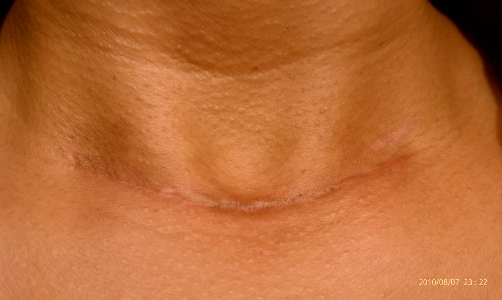 How does my neck look? How does my neck look? 9/10/10