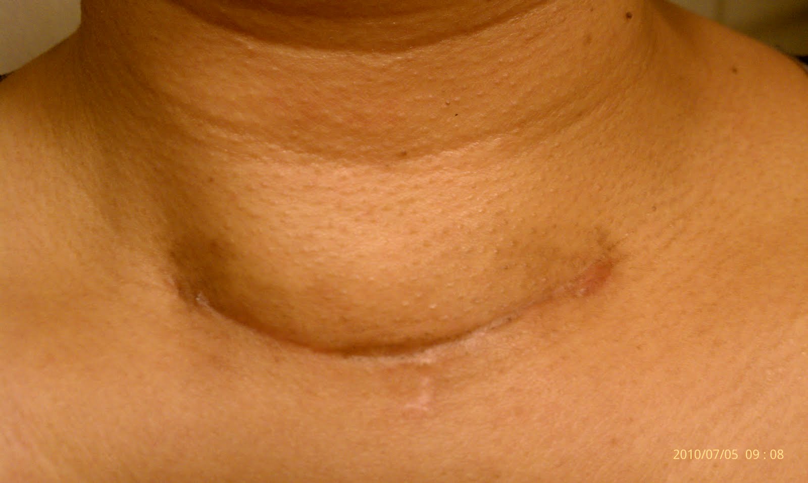 How does my neck look? How does my neck look? 9/10/10