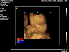 25 weeks