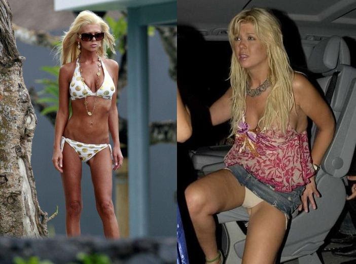 The sloppy, wasted mess that is Tara Reid is gettin' some rehab. 