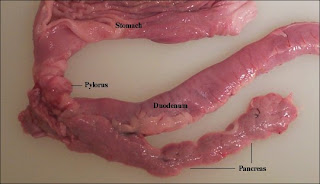 diabetesdisorder: gross anatOmy Of pancreas!