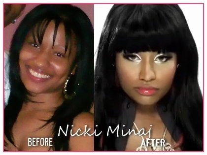 nicki minaj booty before and after. Nicki Minaj: Before Sep 13