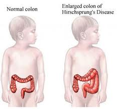 Painful Bowel Movements After Eating Certain Foods On Period Painful Bowel Movements After Eating Certain Foods On Period