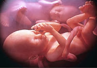 Unborn children are highly susceptible to environmental toxins ingested by their mother