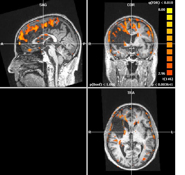 fMRI 3 years in