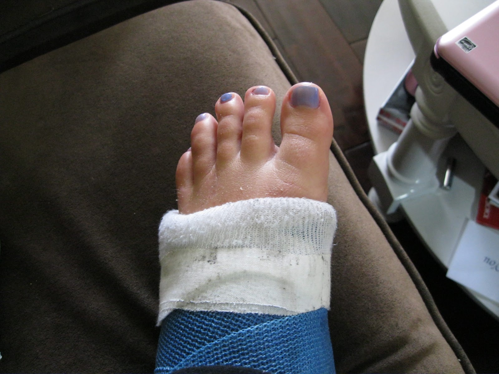 Debi's Achilles recovery Cast Pedicure