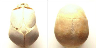 El asombroso Cráneo | Naturaleza asombrosa, maravillas naturales