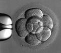 [ISCI+embryos.jpg]