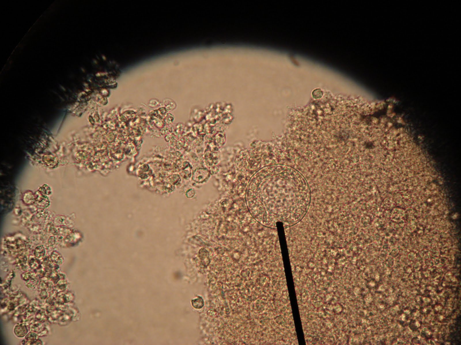 Microbiology: Systemic fungi