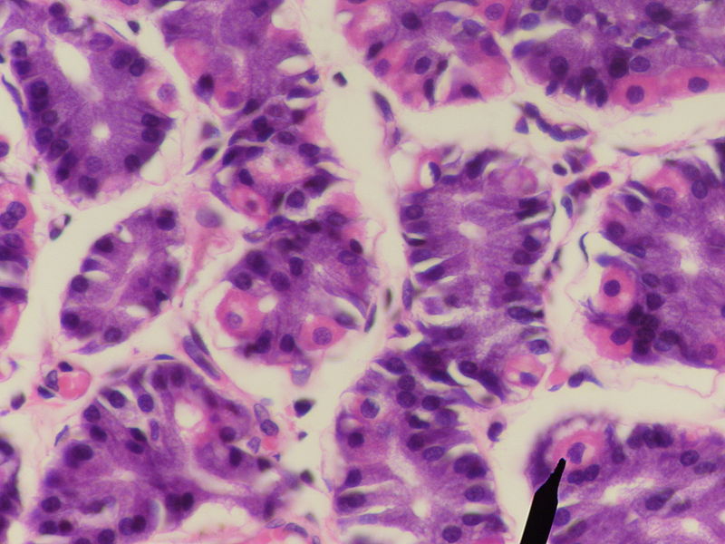 [800px-Parietal_cells.jpg]