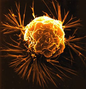[2009041658oncologia_300.jpg]