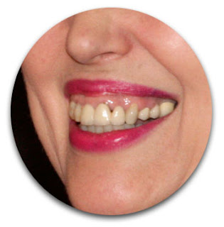 destroy photo: Combien de dents