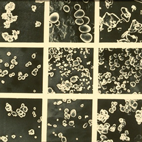 [starch+granule.jpg]