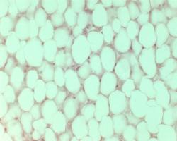 [AdiposeTissue1x40.jpg]