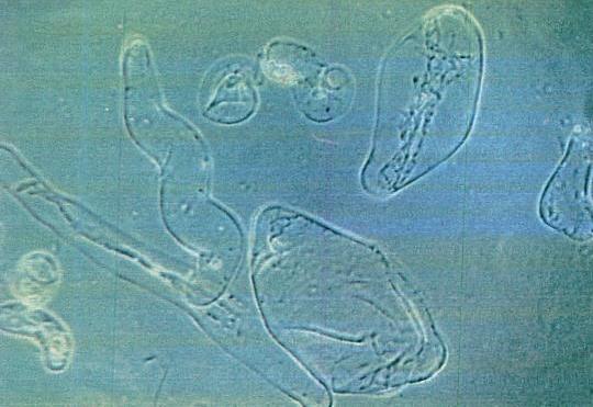 Micrografie di alcune cellule vegetali che crescono in provetta: dimensione 100 millesimi  di mm