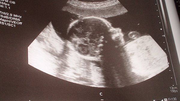 Little girl, week 22