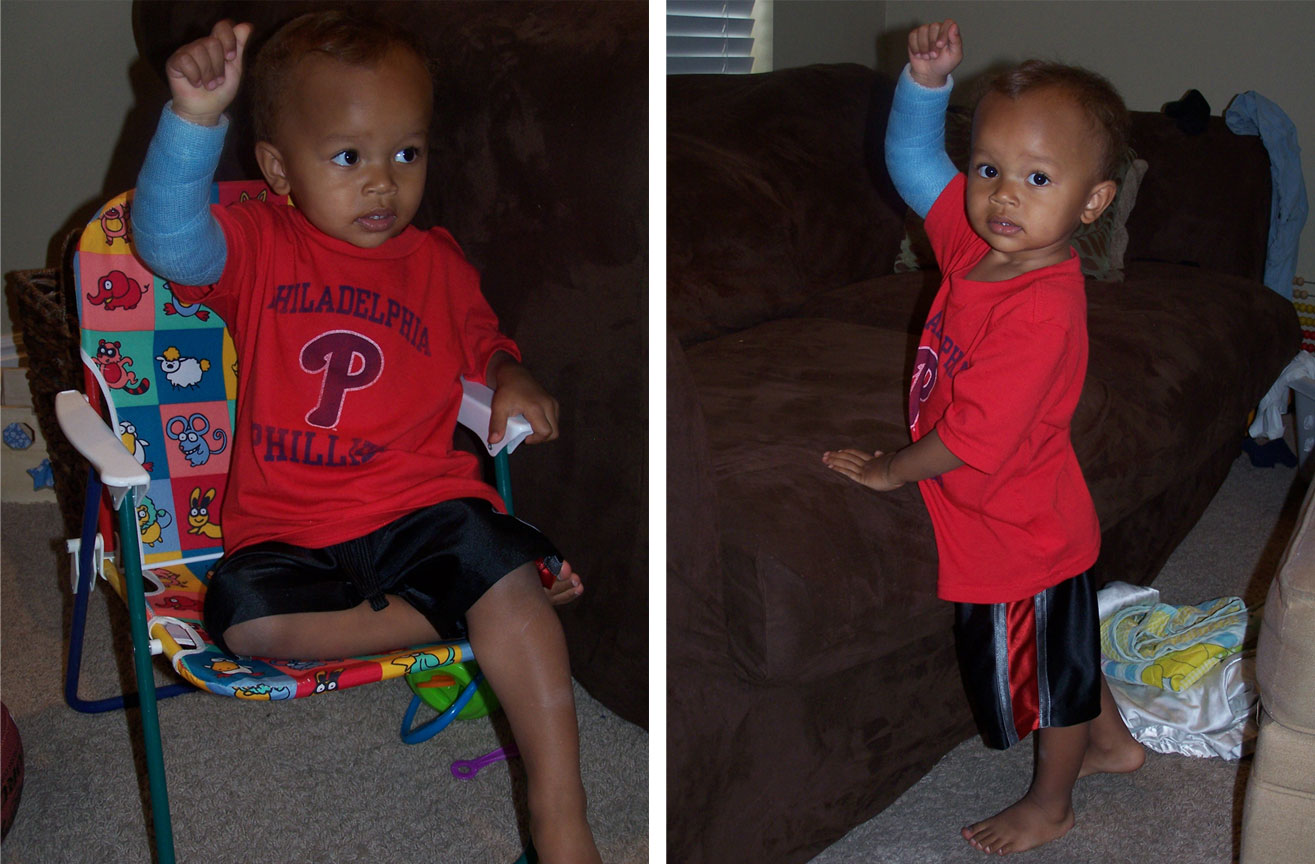 The Ojuka Family The Broken Arm