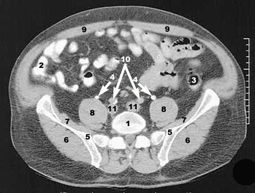 CT PHYSICS 09: Cross-sectional CT images of the abdomen