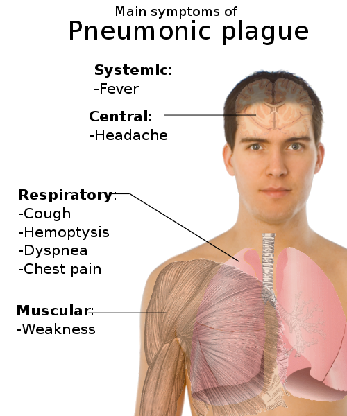 [500px-Symptoms_of_pneumonic_plague.svg.png]