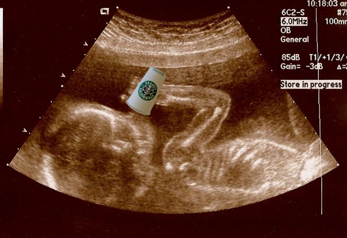 17+ Diagnostic Medical Sonographer at Demax5