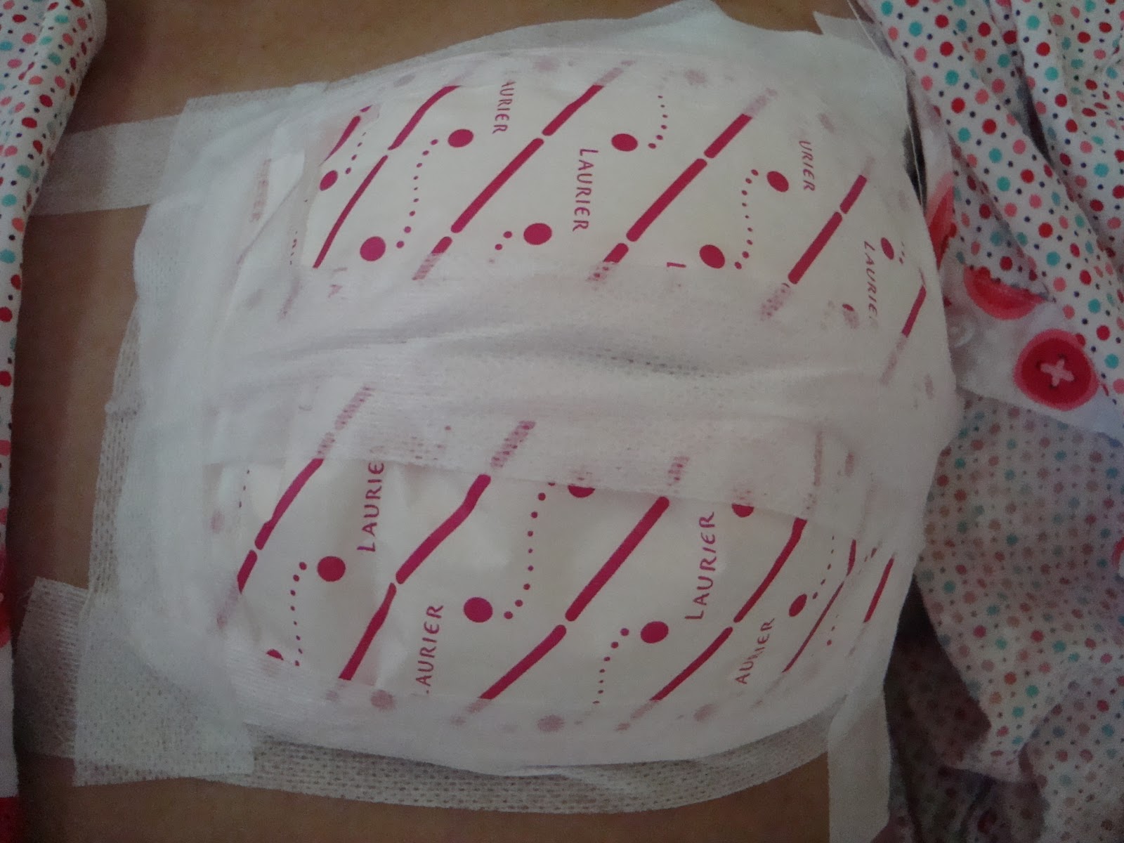 PORTAL ILMU LUKA INDONESIA PEMBALUT WANITA, ALTERNATIF BALUTAN LUKA