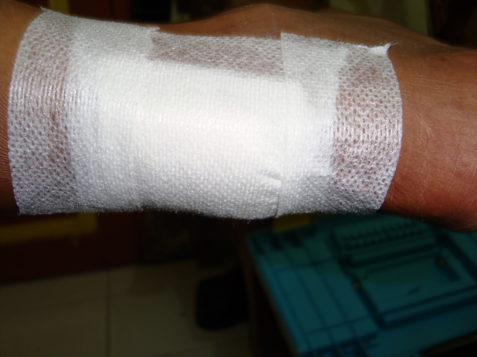 Perawatan Luka Modern Dressing Homecare24