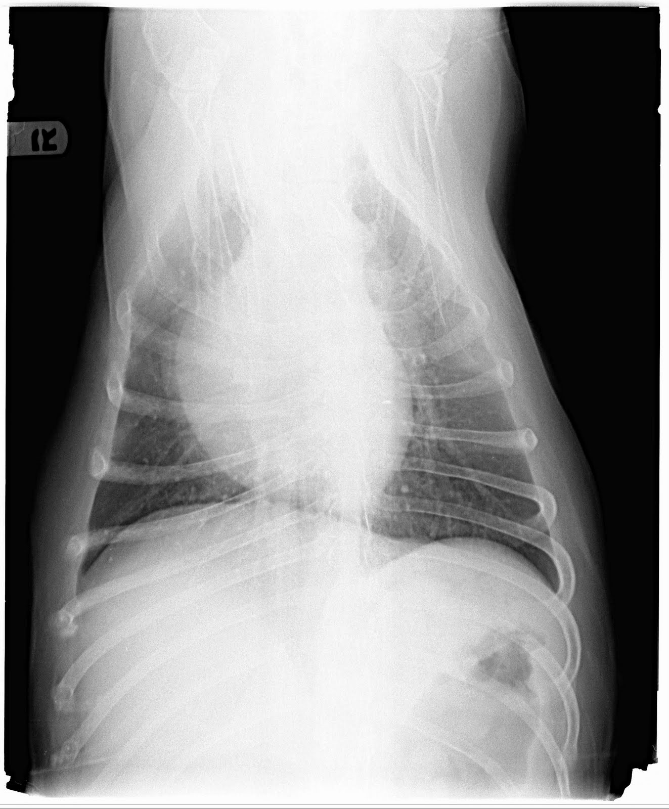 Hokiecoyote Blog Old Dog Lungs?