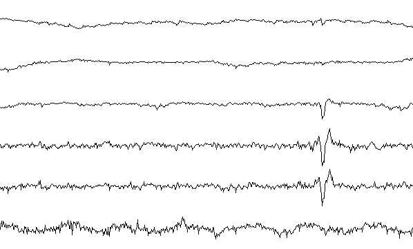 Evolutionary Psychiatry: Sleep Architecture