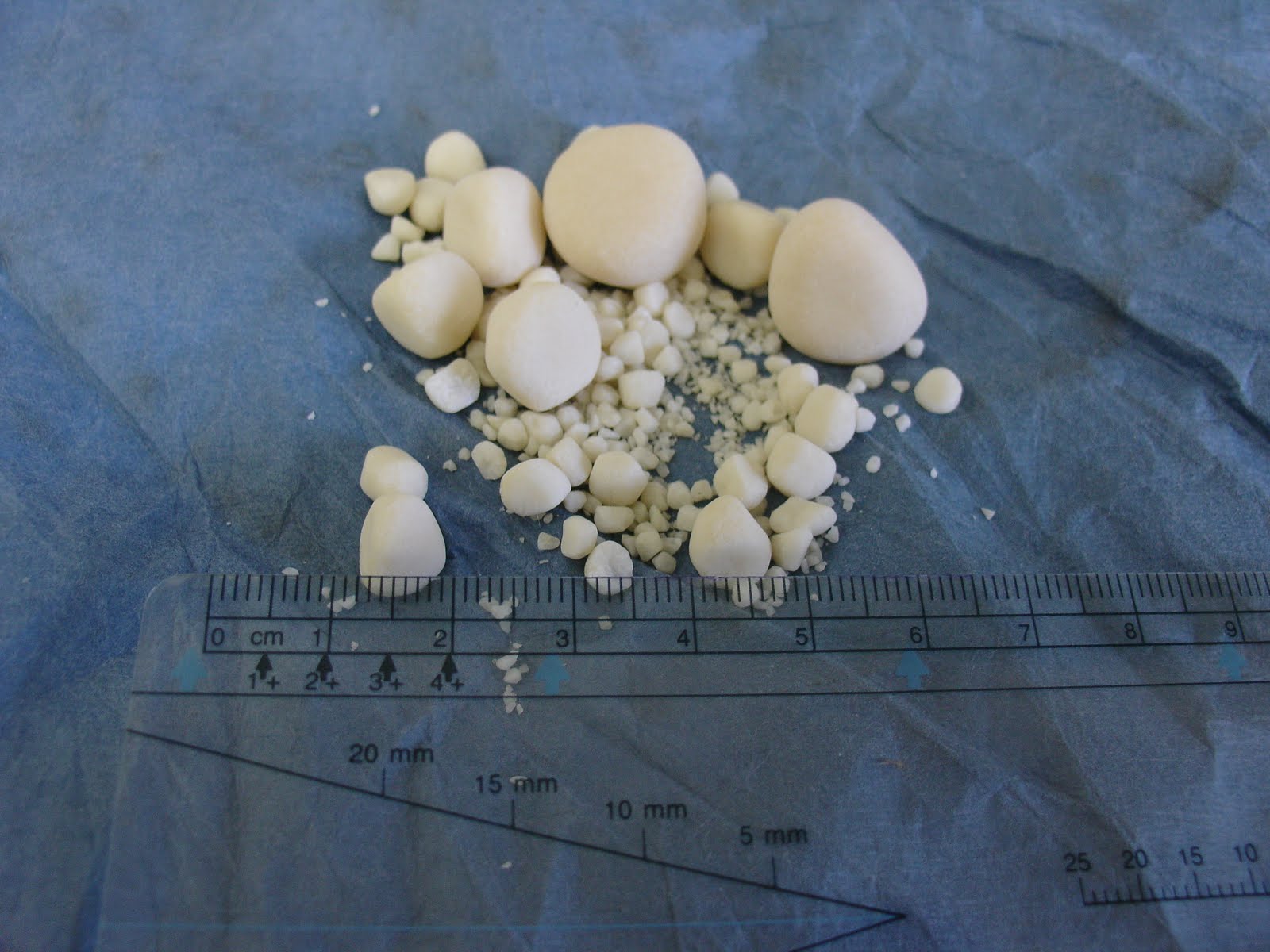 Verandah Pet Vet Urinary Calculi Bladder and Kidney Stones