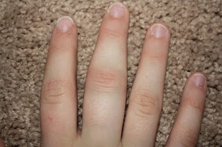 Morgan Small: Jammed Finger