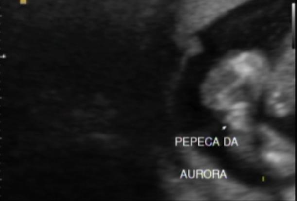 Minha primeira gravidez: 05/04/2010 -> Grandes lábios???