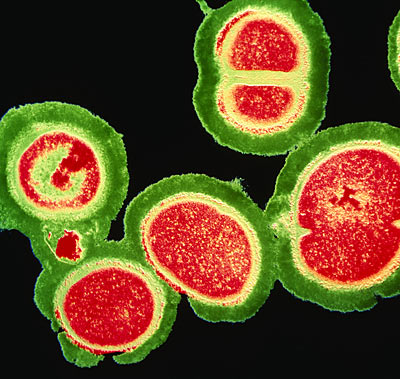[mrsa.jpg]