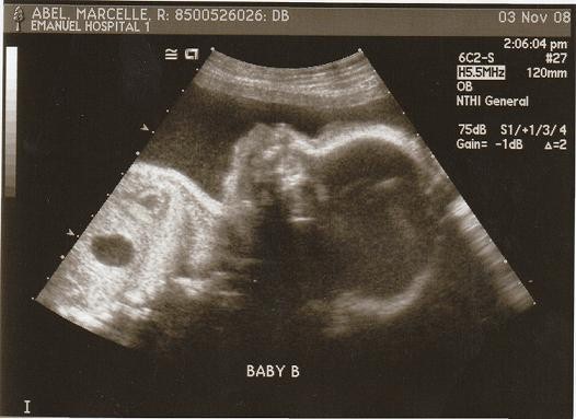 28 week ultrasound