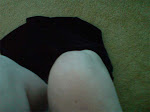 Lump on knee 2008