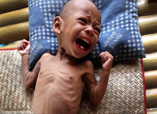 500 Million Children at Risk of Malnutrition 