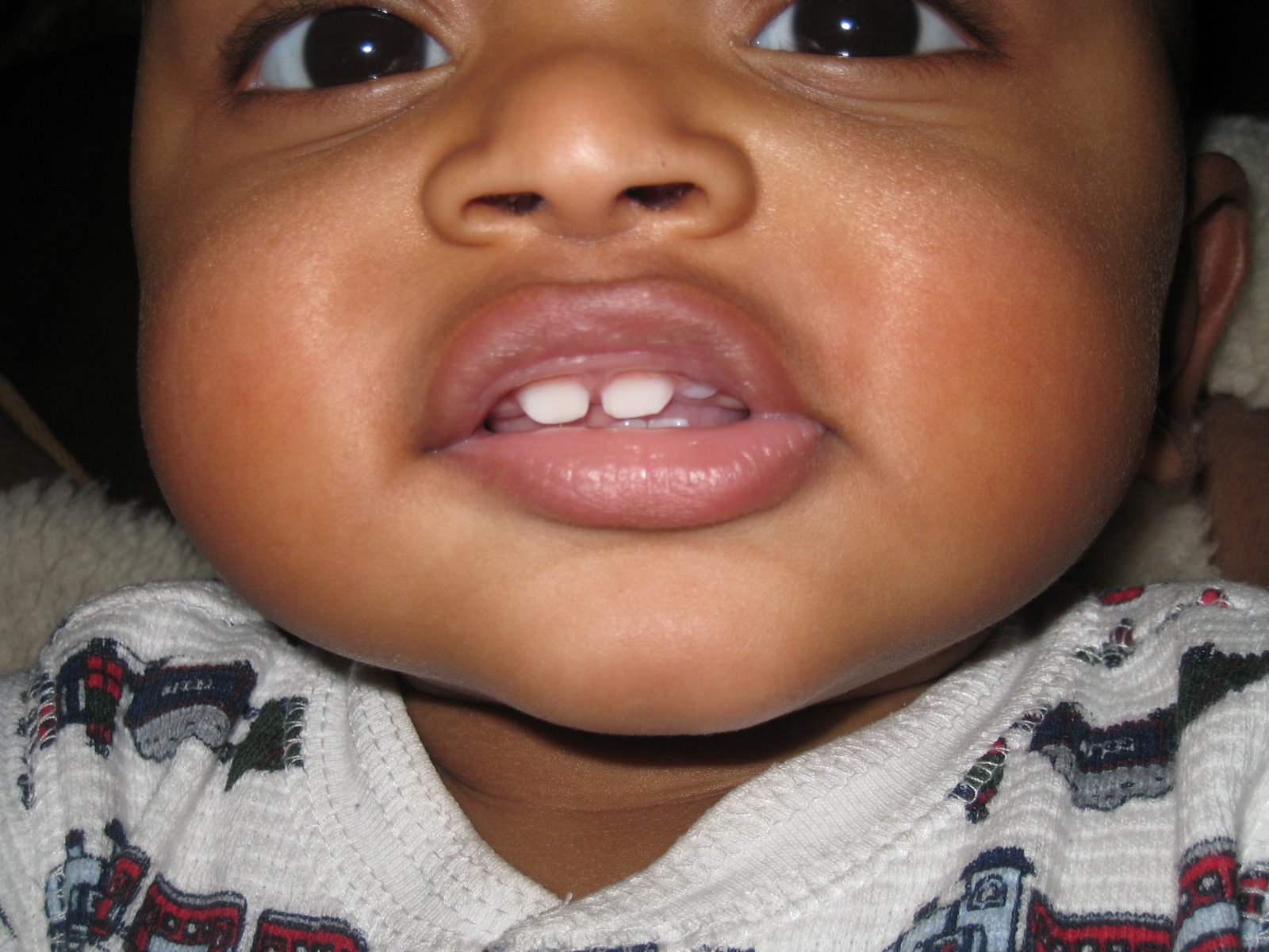 [010210_MylesNewTeethTop_4.JPG]