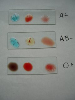 [grupos+sanguineos[1].jpg]