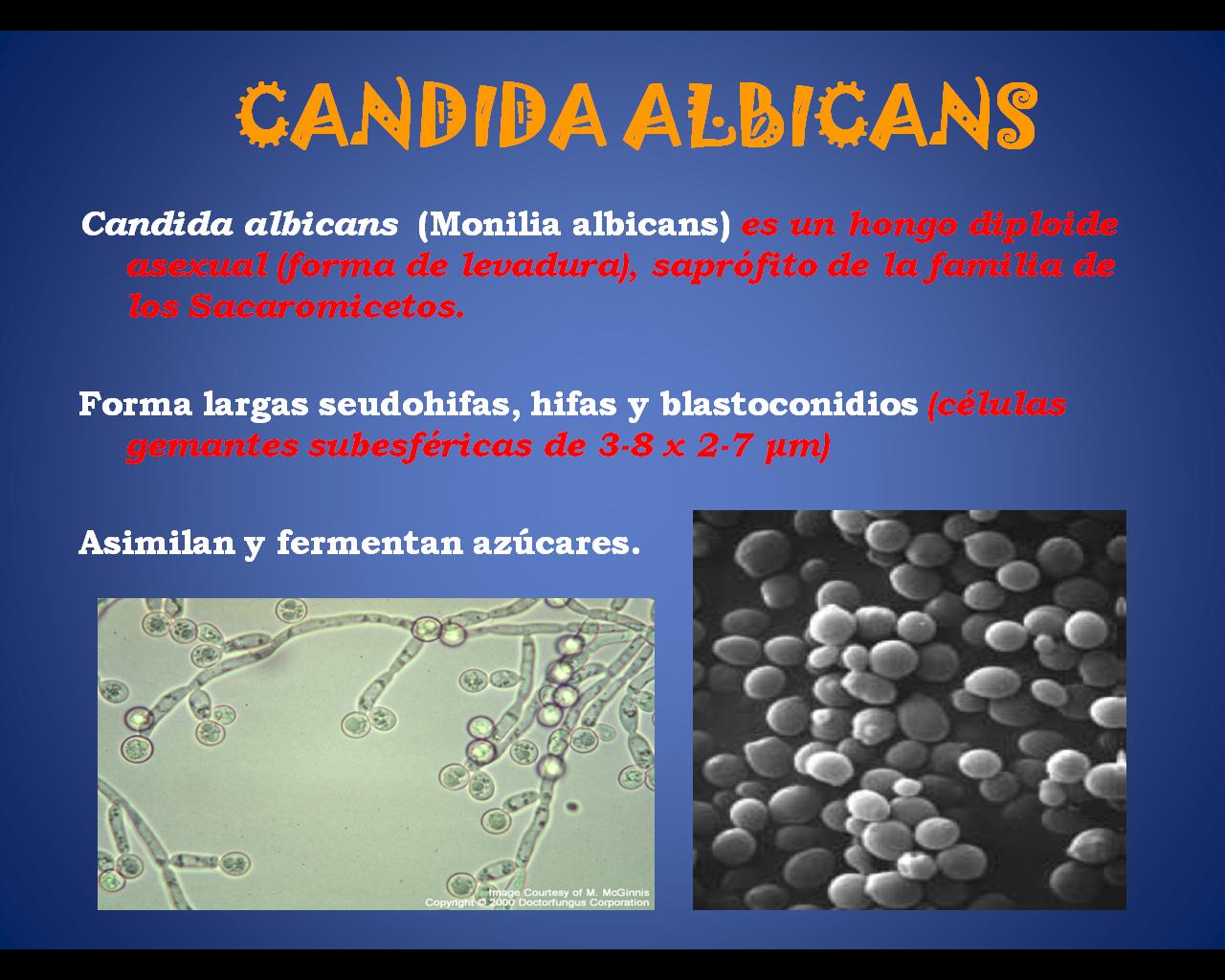 Candida albicans лечение. Candida albicans возбудитель. Кандида альбиканс строение. Candida albicans в патологическом материале.