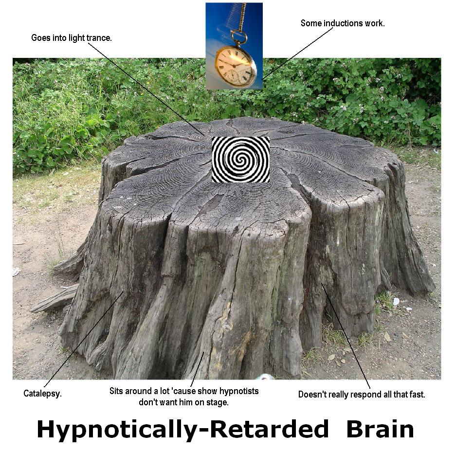 [Hypnotically+retarded+brain.jpg]