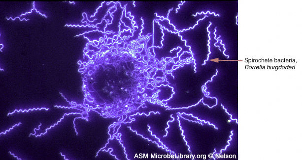 Borrelia Burgdorferi