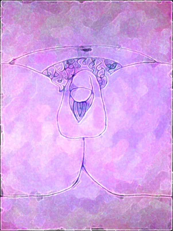 [Perineal+Hypospadias+Chordee+Sketch.jpg]