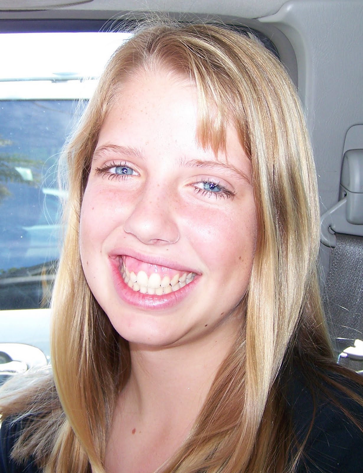 braces got 5th august