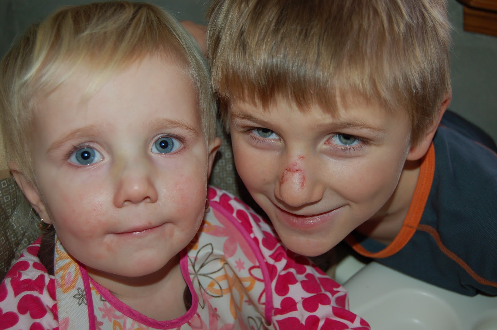 Small Wonders Two Broken Noses