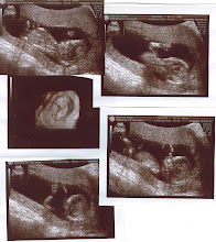 We got lots of pictures!