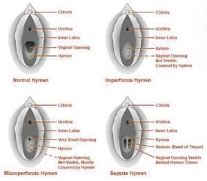 what is the evolutionary purpose of the hymen