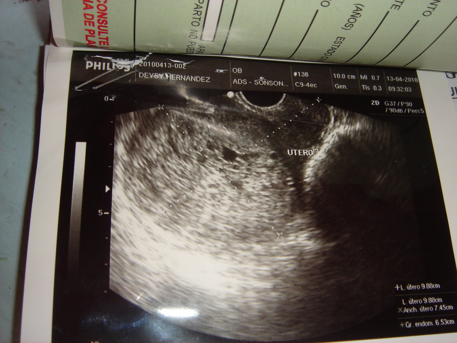 Throwing Glass Bottles: Snowstorm in El Salvador